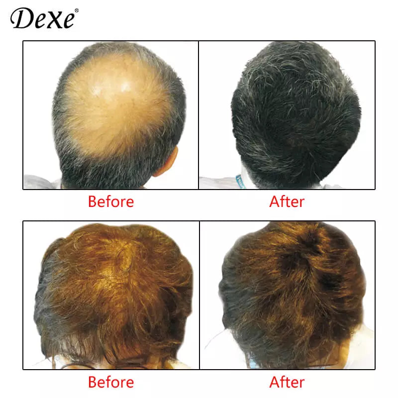 DEXE HAIR BUILDING FIBERS