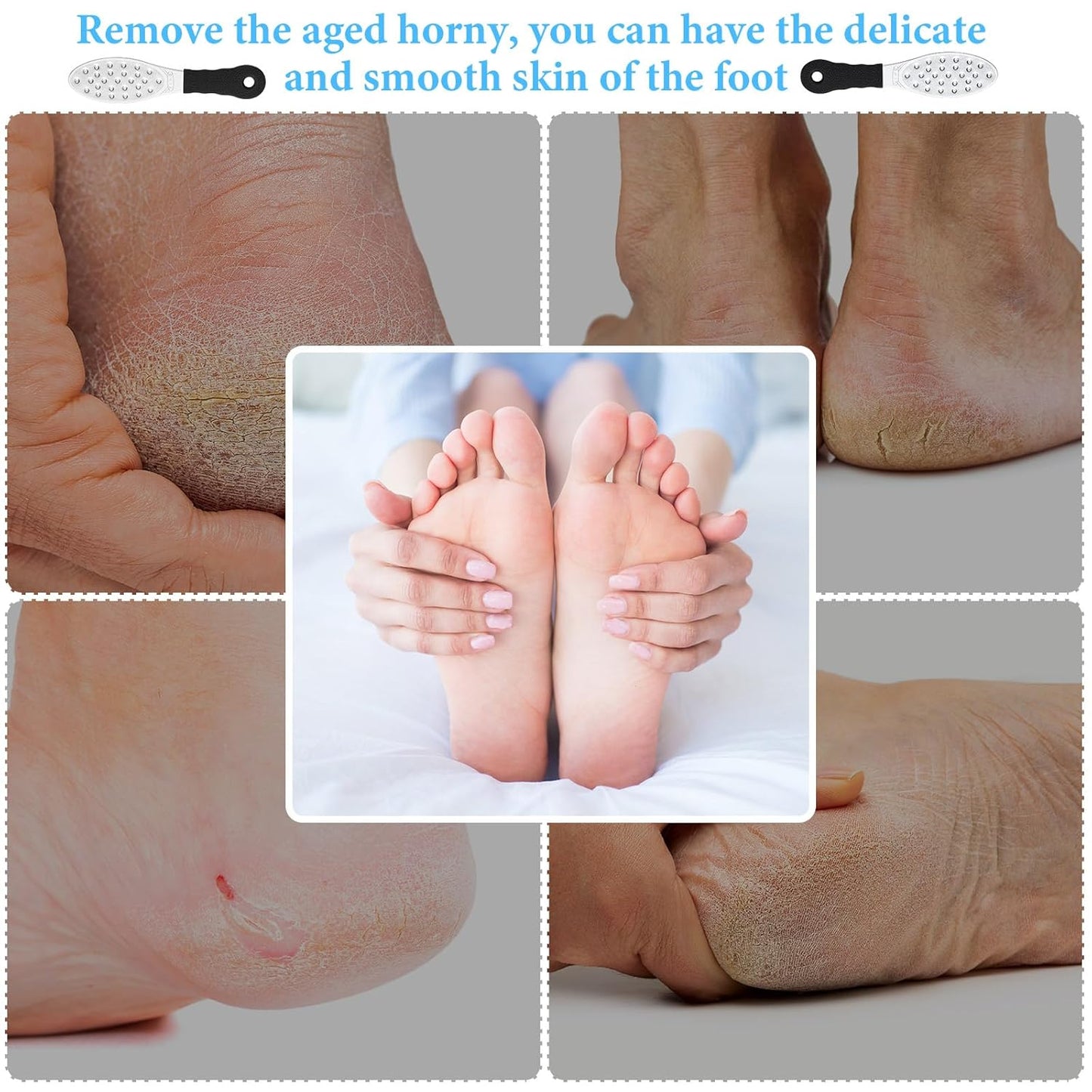 Foot Scraper Metal Foot File β Double-Sided Callus Remover & Foot Rasp β Pedicure Tool β 1 PCS