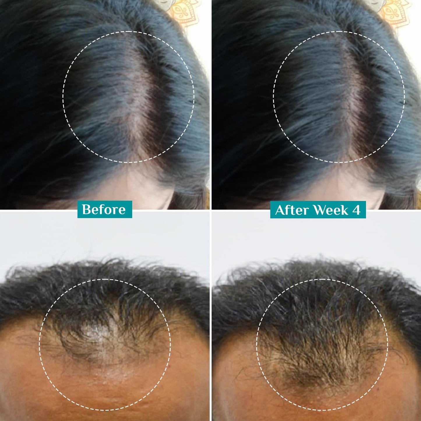 Pilgrim Redensyl 3% + Anagain 4% + Baicapil Advanced Hair Growth Serum