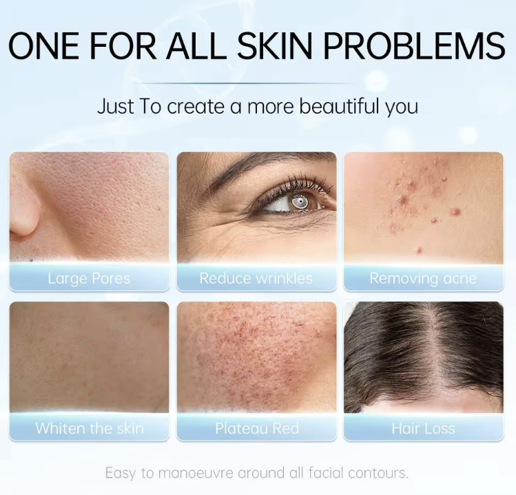 Beauty Derma stamp 140A Micro-needling Tool for Effective Skin Rejuvenation