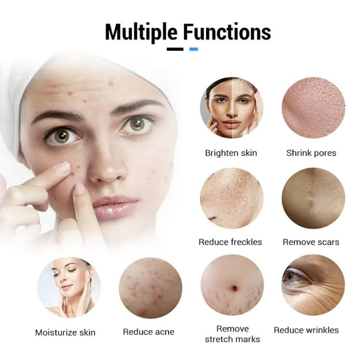 Beauty Derma stamp 140A Micro-needling Tool for Effective Skin Rejuvenation