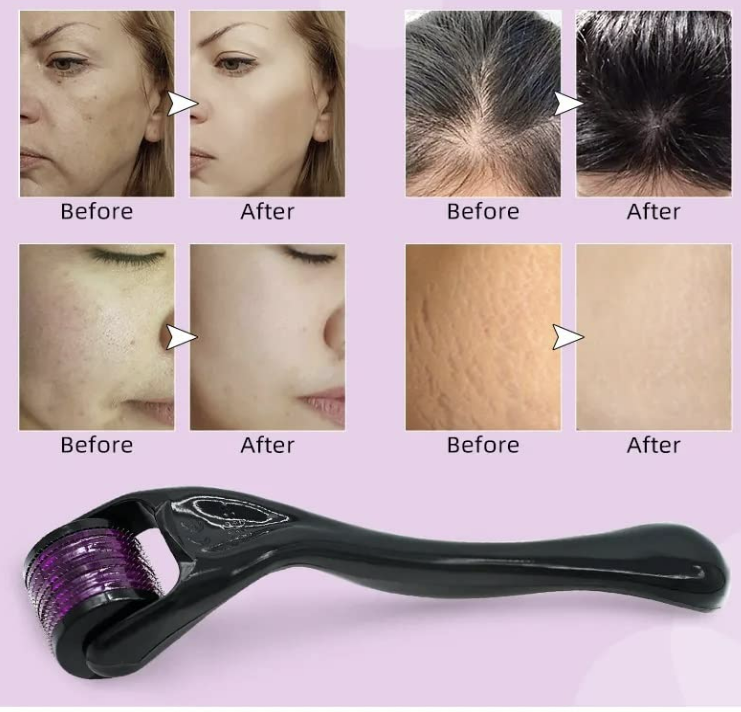 Derma Roller 0.5 mm Derma Roller Derma roller FOR Hair Regrowth