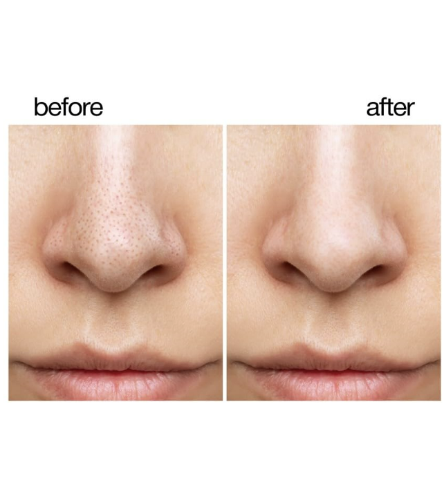 TEEN TEEN Deep Cleansing Nose Pore Strips (Pack of 10 Strips)