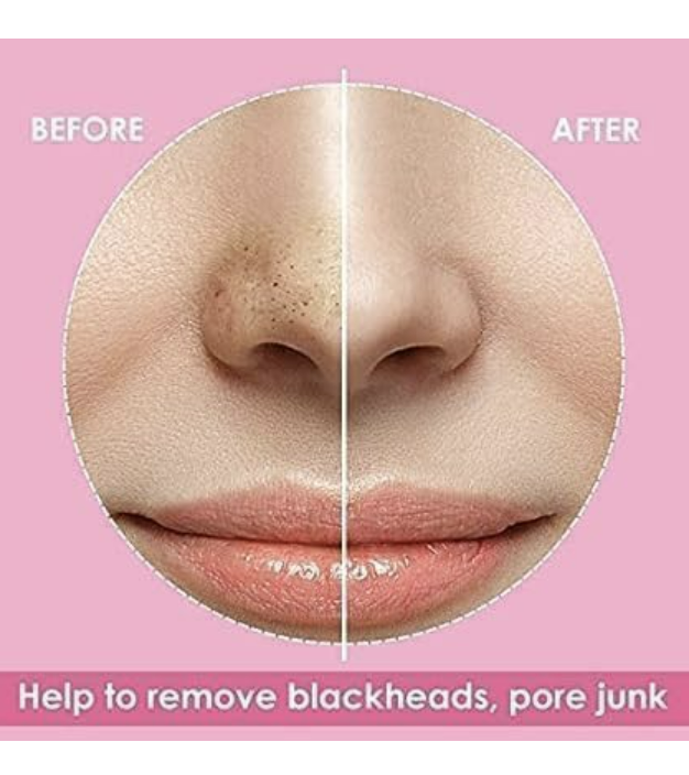 BESCHBORN Deep Cleansing Nose Pore Strips for Blackhead Removal(10 strips)