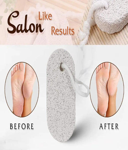 Stone & Natural Pumice Stone – Foot Scrubber for Dry, Hard Skin