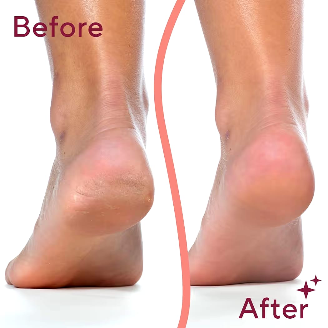 Flawless Pedi β Electronic File & Callus Remover
