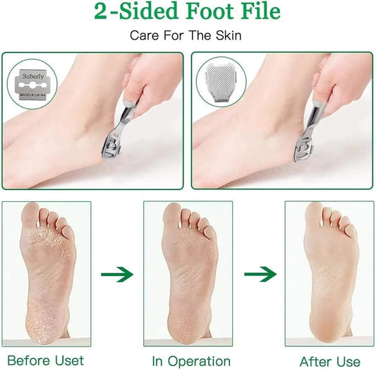 ZINGER Stainless Steel Corn cutter Dead Hard Skin Remover