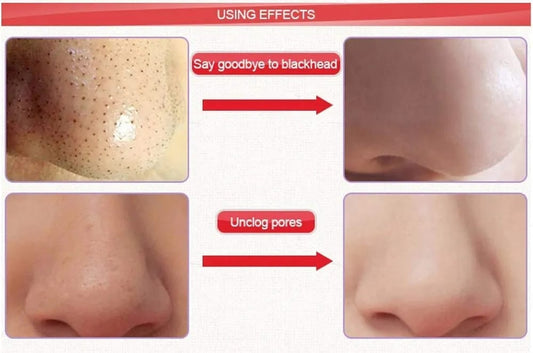 CAMELEON DEEP CLEANSING NOSE PORE STRIPS