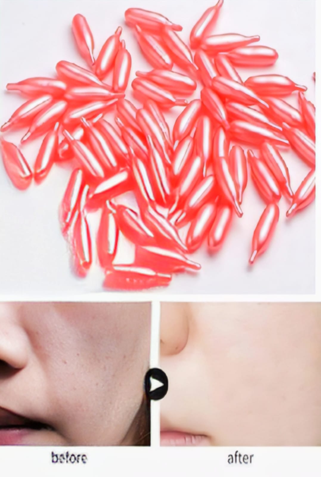 Vitamin E Facial Oil Soft Gel Capsules