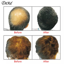 DEXE HAIR BUILDING FIBERS