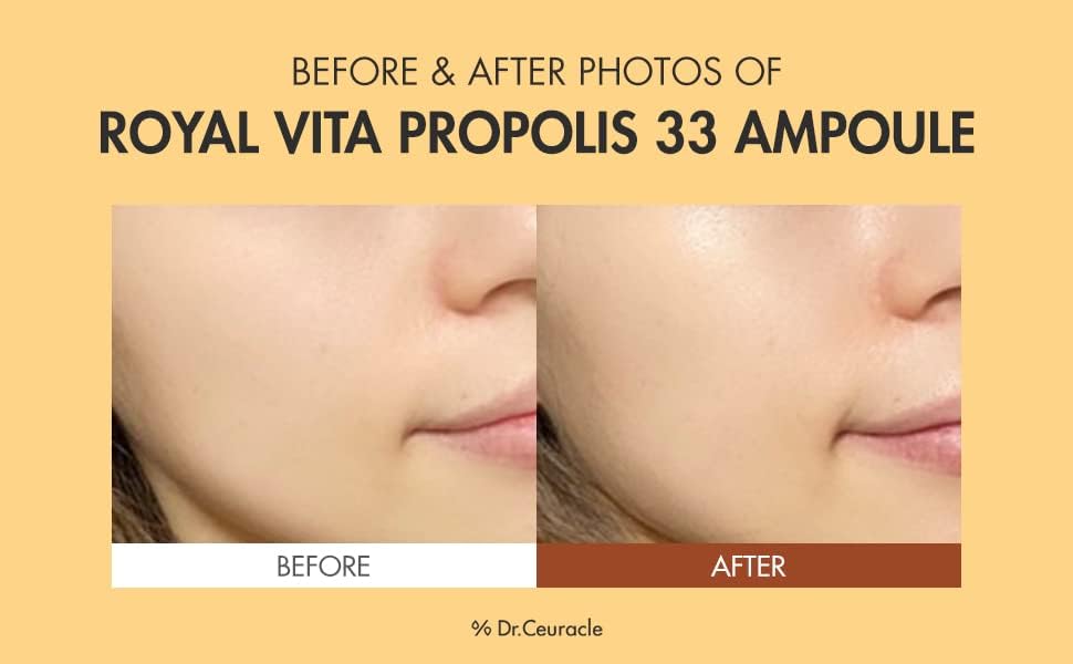 Dr.Ceuracle Royal Vita Propolis Ampoule