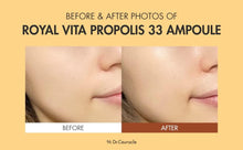 Dr.Ceuracle Royal Vita Propolis Ampoule