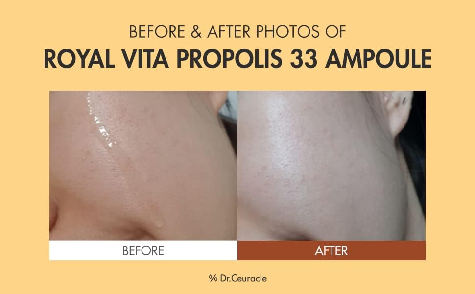 Dr.Ceuracle Royal Vita Propolis Ampoule