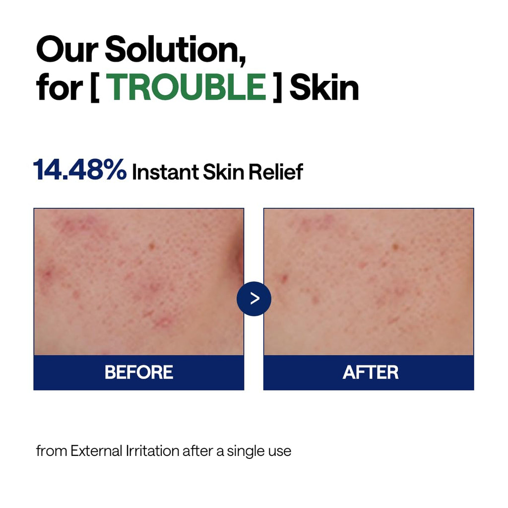 MEDIHEAL Tea Tree Calming Hydra Serum 40ml