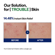 MEDIHEAL Tea Tree Calming Hydra Serum 40ml