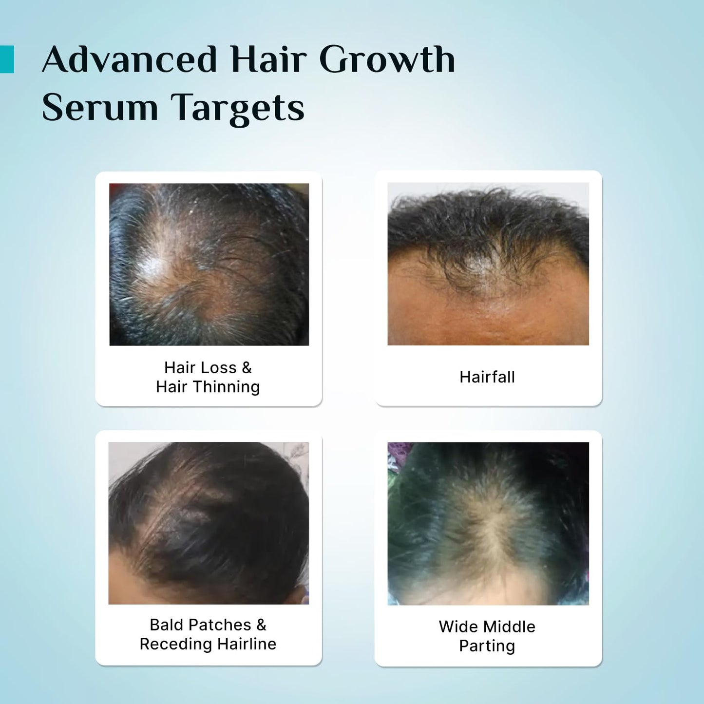 Pilgrim Redensyl 3% + Anagain 4% + Baicapil Advanced Hair Growth Serum