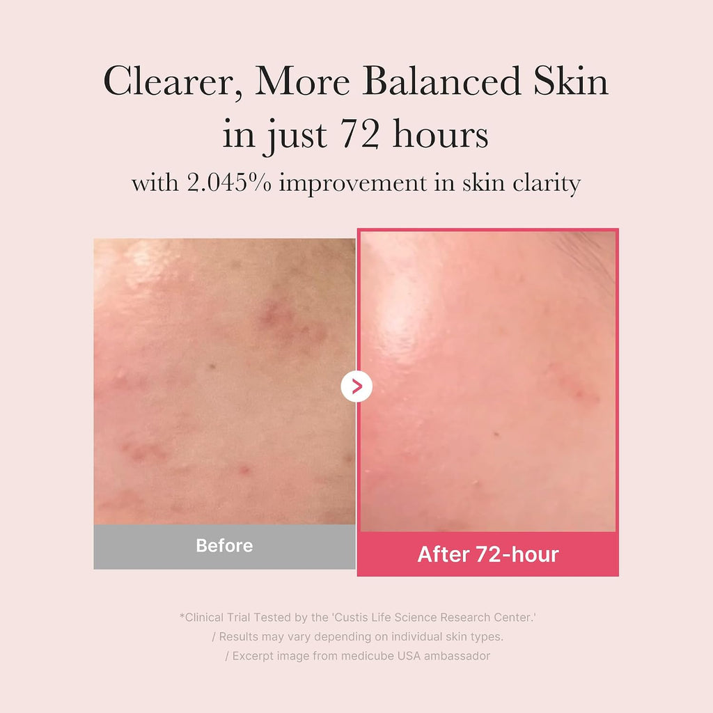 Medicube TXA + Niacinamide 15% Glow Serum 30ml