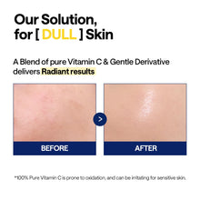MEDIHEAL Vitamin C Brightening Serum
