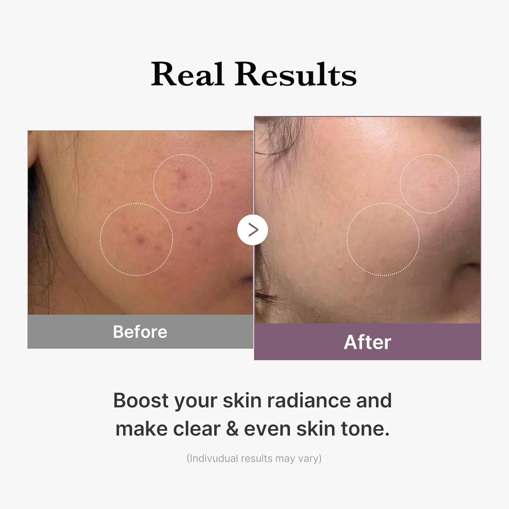 Medicube Age-R Glutathione Glow Milky Toner (140ml) - The beauty cart
