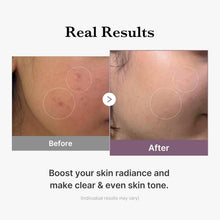 Medicube Age-R Glutathione Glow Milky Toner (140ml) - The beauty cart