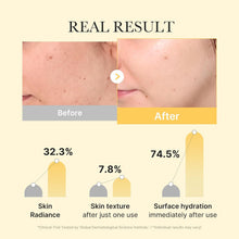 Medicube Kojic Acid Turmeric Brightening Gel Mask - The beauty cart