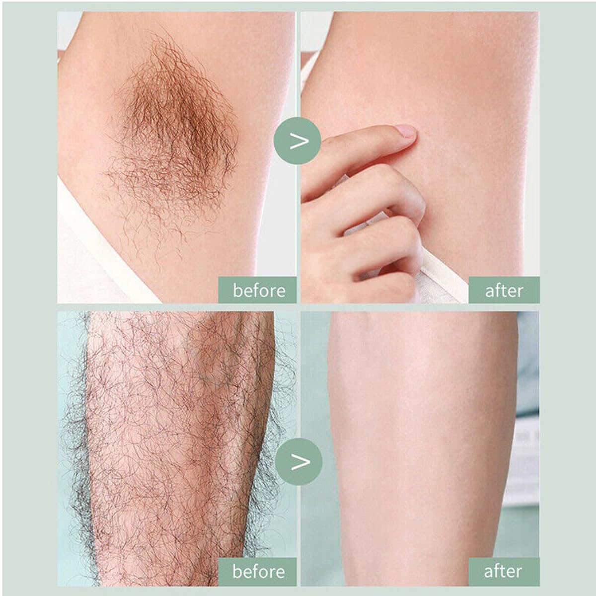 ANNINA Micro-Axillary Hair Knife
