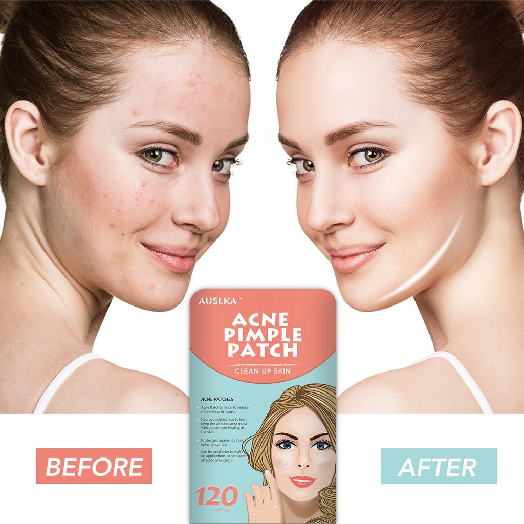 Acne Pimple Master Patch  Hydrocolloid Acne Spot Treatment (120 Patches)