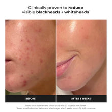 Paula's Choice Skin Perfecting 2% BHA Liquid Exfoliant  118ml