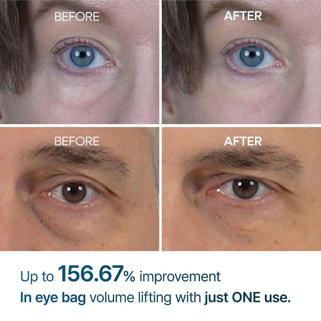 Dr.Melaxin Eyephalt Eye Cream puffiness, dark circles, fine lines, and wrinkles.