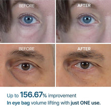 Dr.Melaxin Eyephalt Eye Cream puffiness, dark circles, fine lines, and wrinkles.