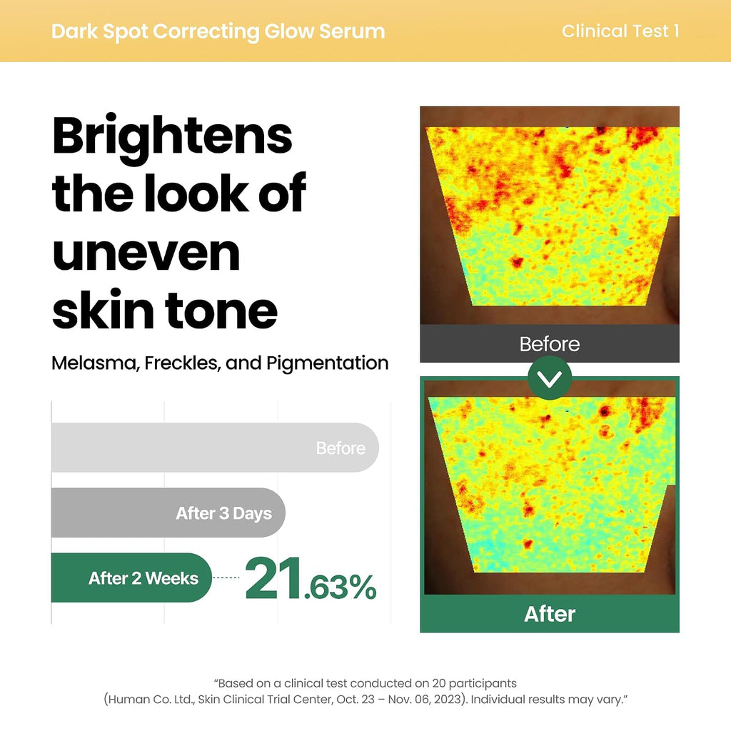 AXIS-Y Dark Spot Correcting Glow Serum (50ml)