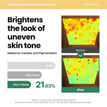 AXIS-Y Dark Spot Correcting Glow Serum (50ml)