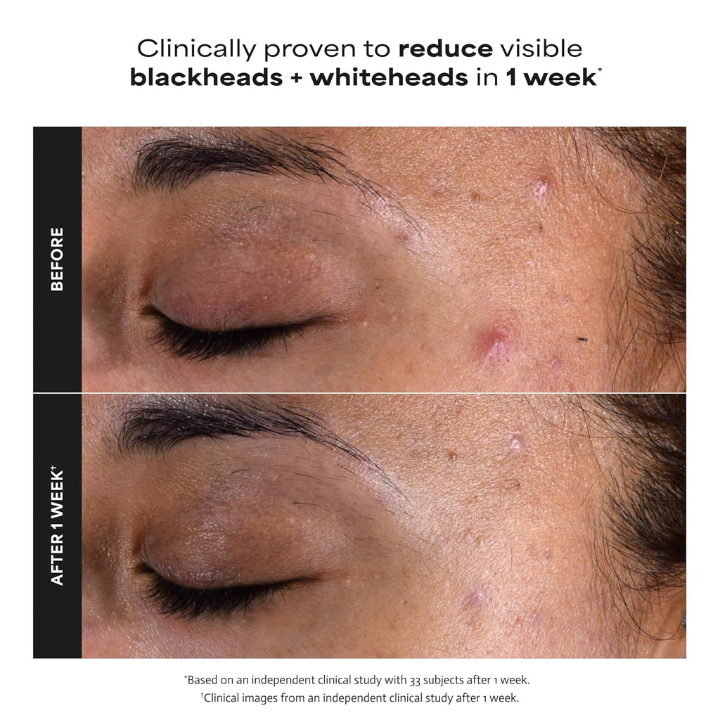 Paula's Choice Skin Perfecting 2% BHA Liquid Exfoliant  118ml