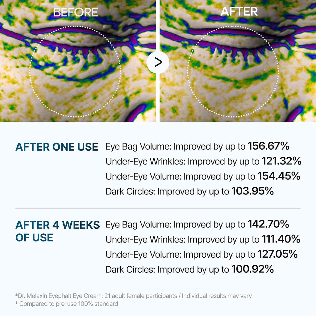 Dr.Melaxin Eyephalt Eye Cream puffiness, dark circles, fine lines, and wrinkles.