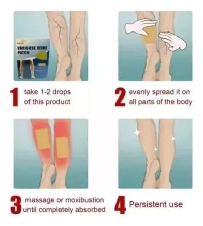 ROYAL PRESTIGE VARICOSE VEINS PATCH