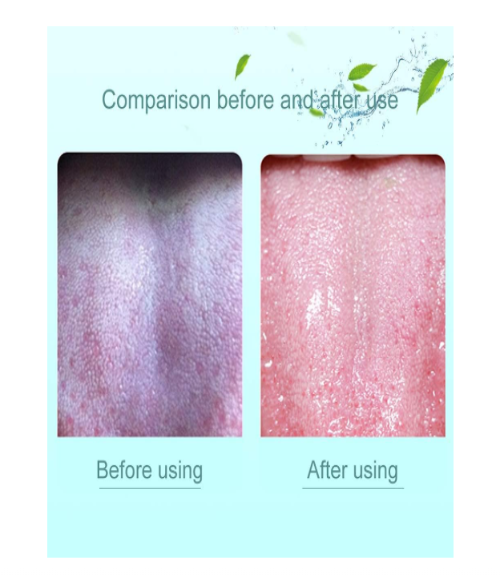 Tongue Scraper for Adults