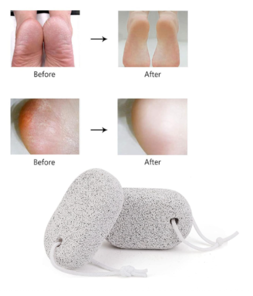 Stone Foot – Natural Exfoliating Stone for Smooth, Soft Feet