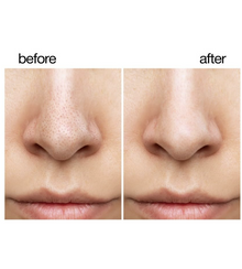 TEEN TEEN Deep Cleansing Nose Pore Strips (Pack of 10 Strips)