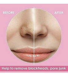 BESCHBORN Deep Cleansing Nose Pore Strips for Blackhead Removal(10 strips)