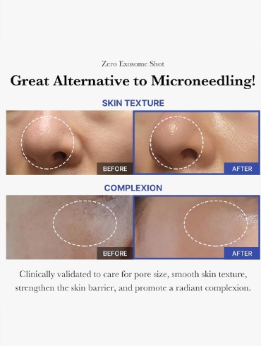 Medicube Korean One Day Exosome Shot Serum