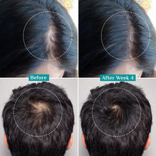 Pilgrim Advanced Hair Growth Serum Roll On (25 ml)