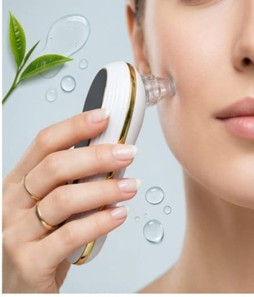Mini Blackhead Remover – Pore Vacuum Cleaner