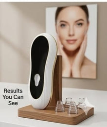 Mini Blackhead Remover – Pore Vacuum Cleaner