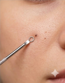 Steel Blackhead Remover Needleo