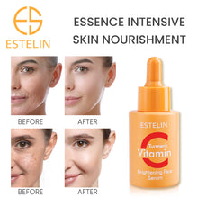 Vitamin C & Turmeric Brightening Face Serum 30ML