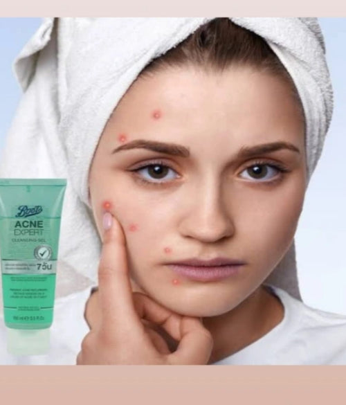 BOOTS Acne Expert Cleansing Gel