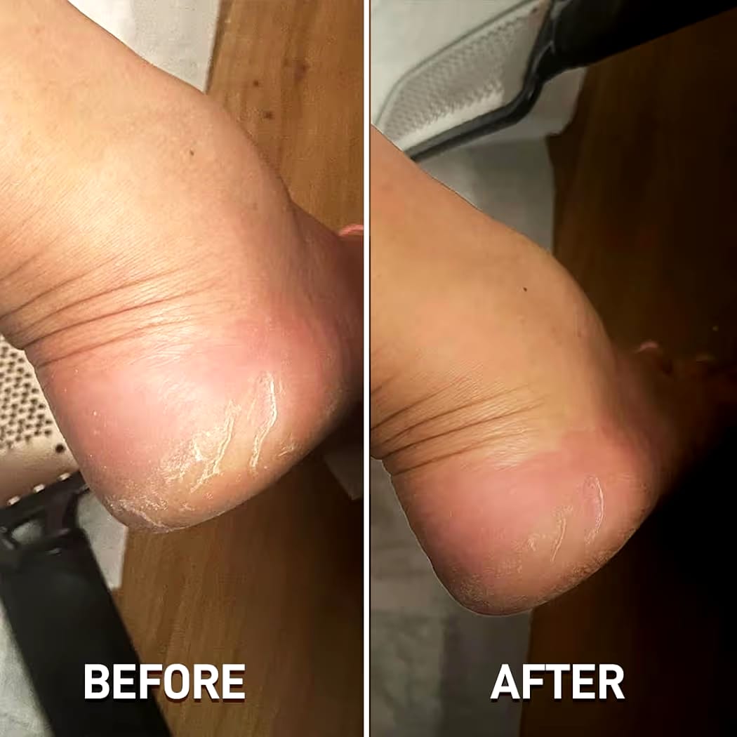 Foot File Callus Remover Pedicure Scrubber Tool for Feet Care