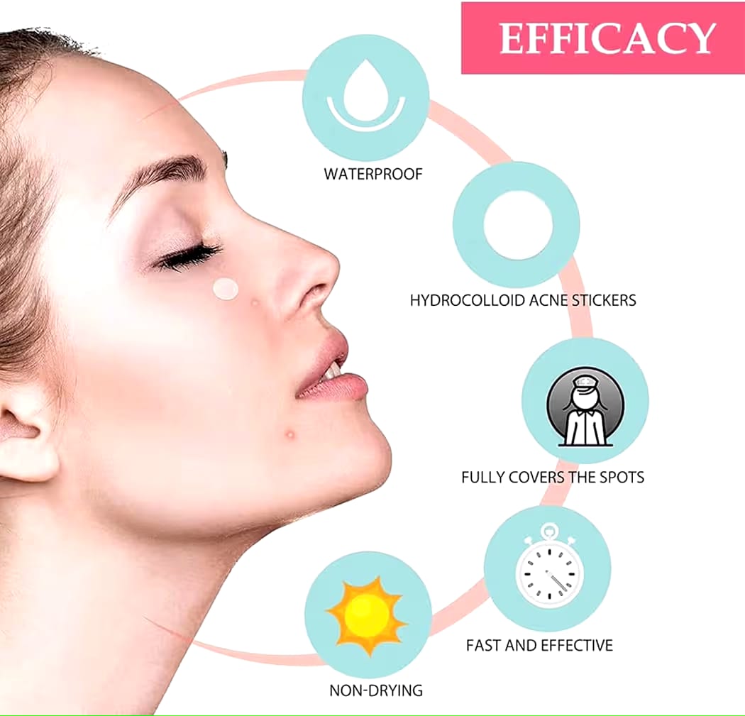 Royal Prestige Acne Pimple Patch – Quick &amp Easy