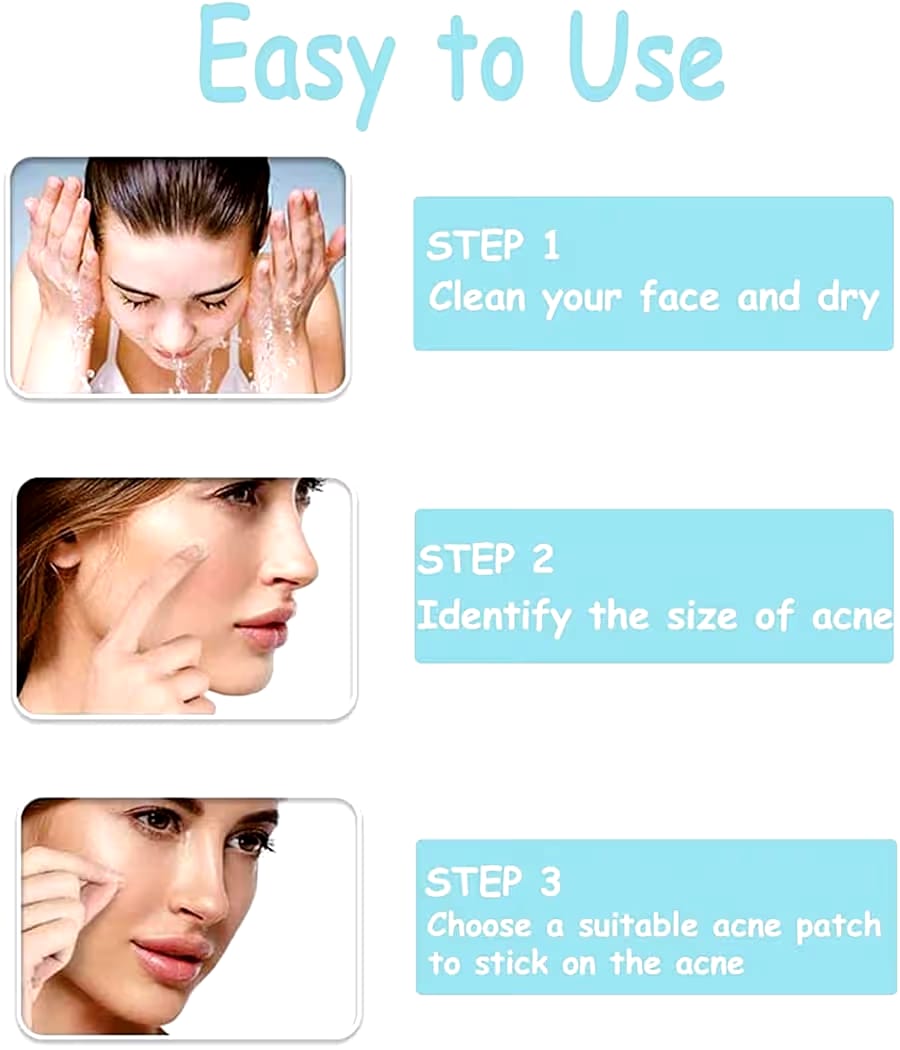 Royal Prestige Acne Pimple Patch – Quick &amp Easy