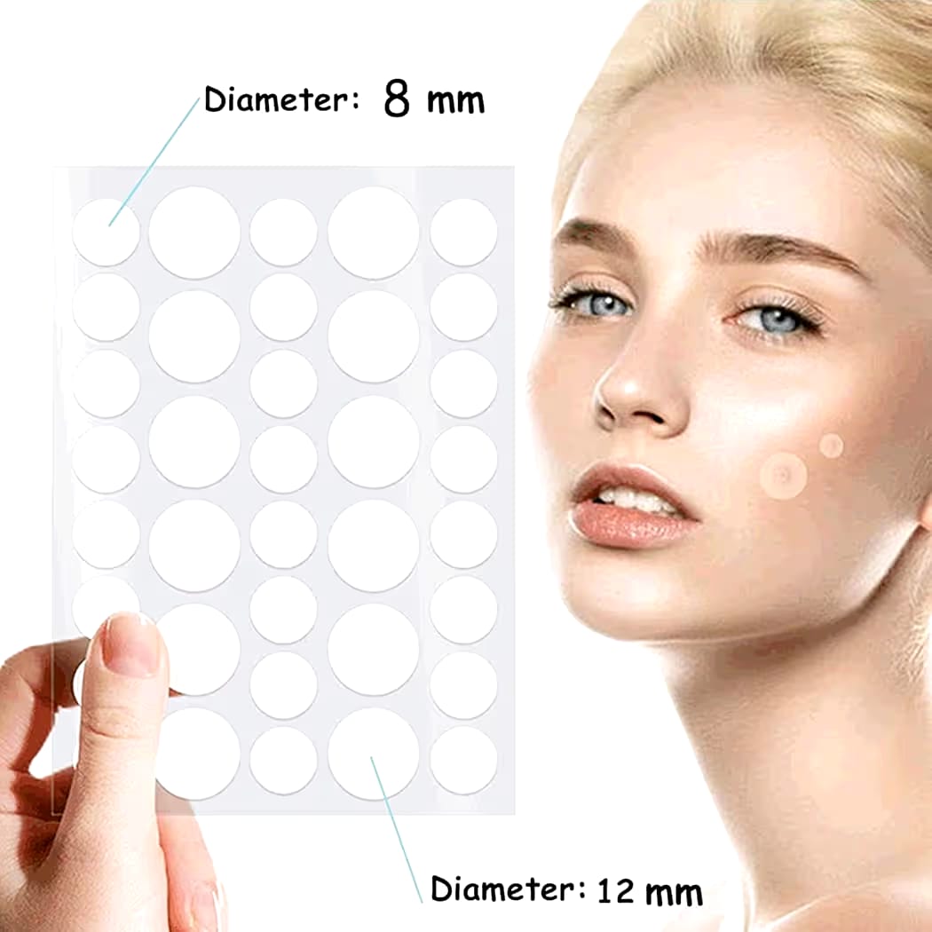 Royal Prestige Acne Pimple Patch – Quick &amp Easy